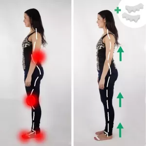 silikonski-distančnik-za-prste-hallux